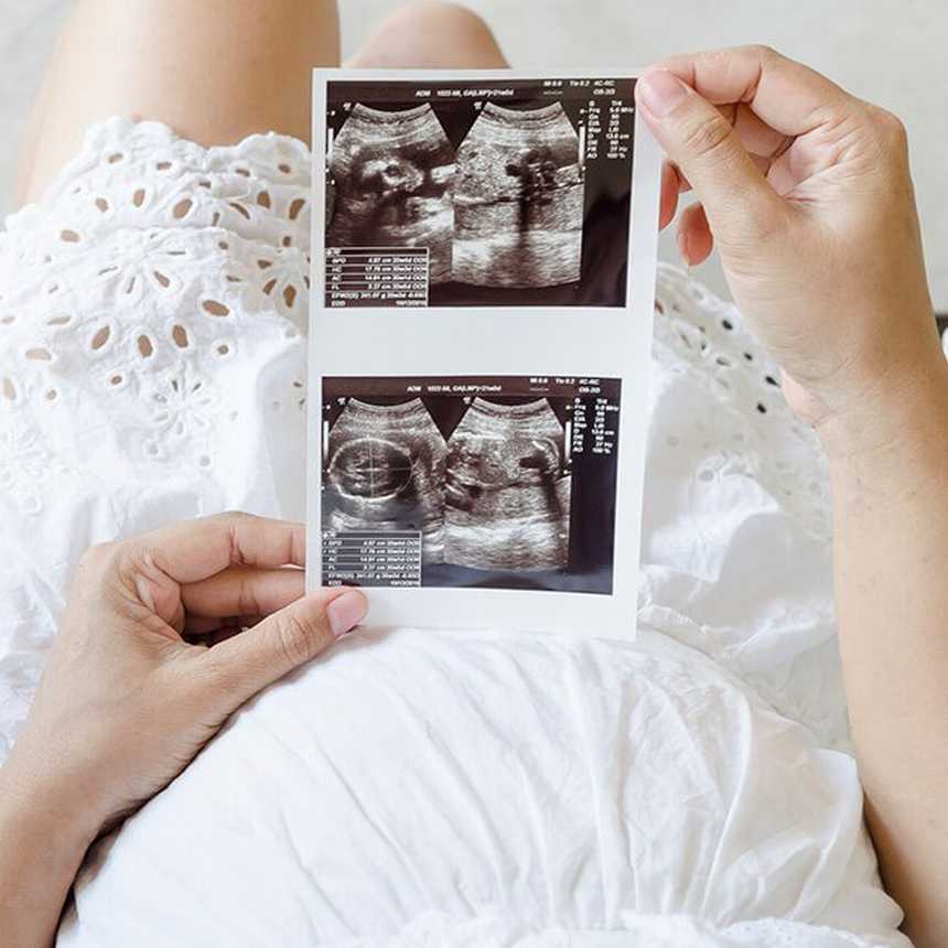  Early Indicators & Signs of Being pregnant